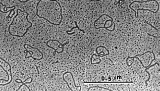 A transmission electron micrograph of viral DNA