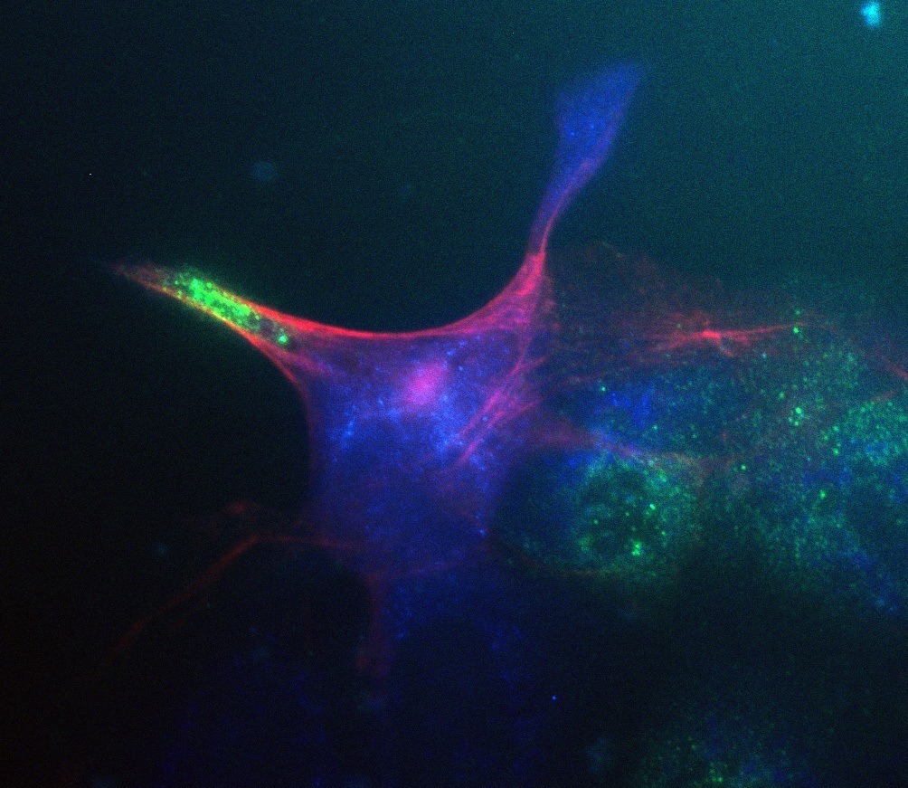 A confocal micrograph of a fluorescing cell