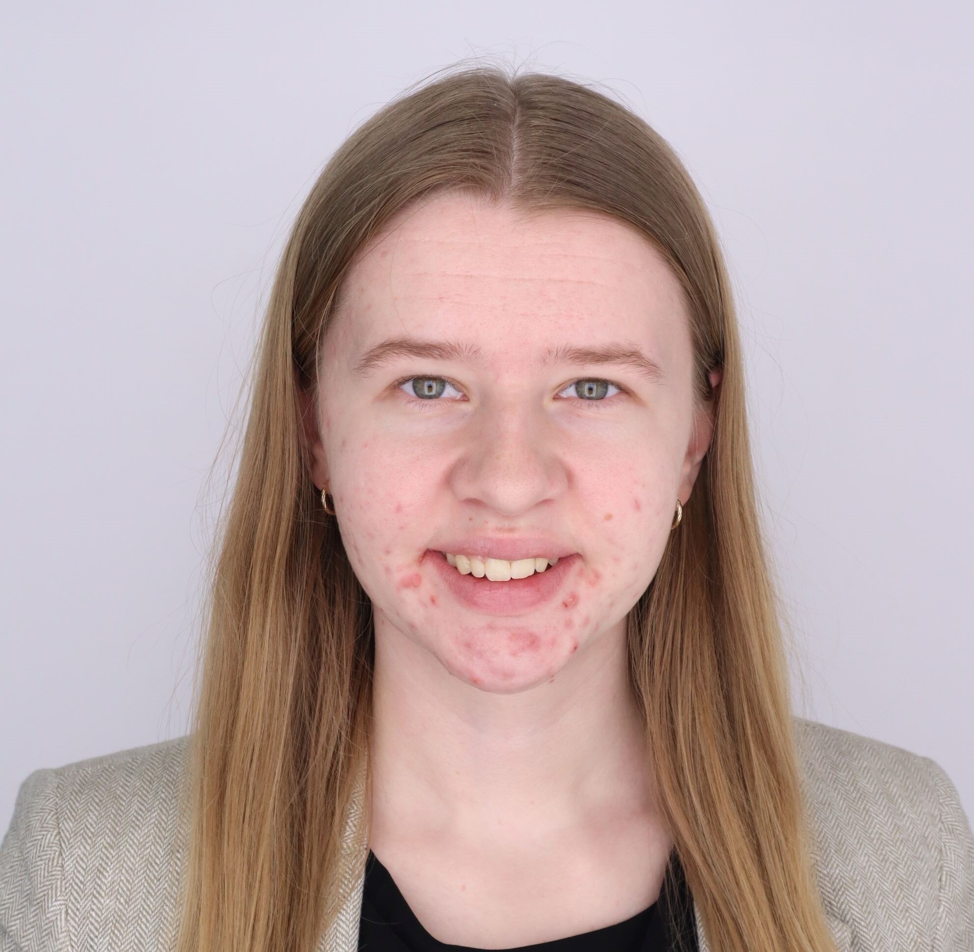 Mariyln Lott - Peer Leader