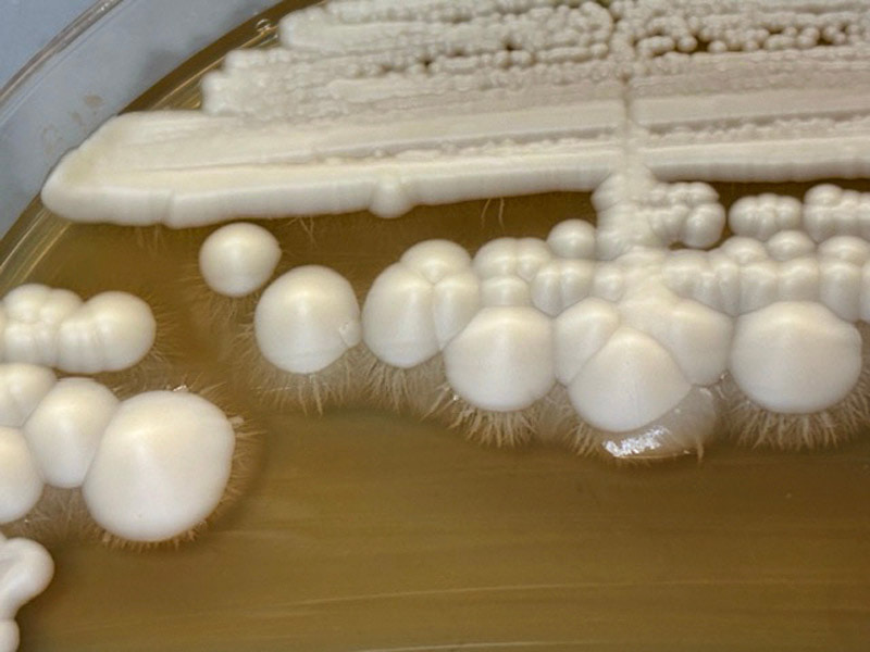 Fungal growth in a petri dish.