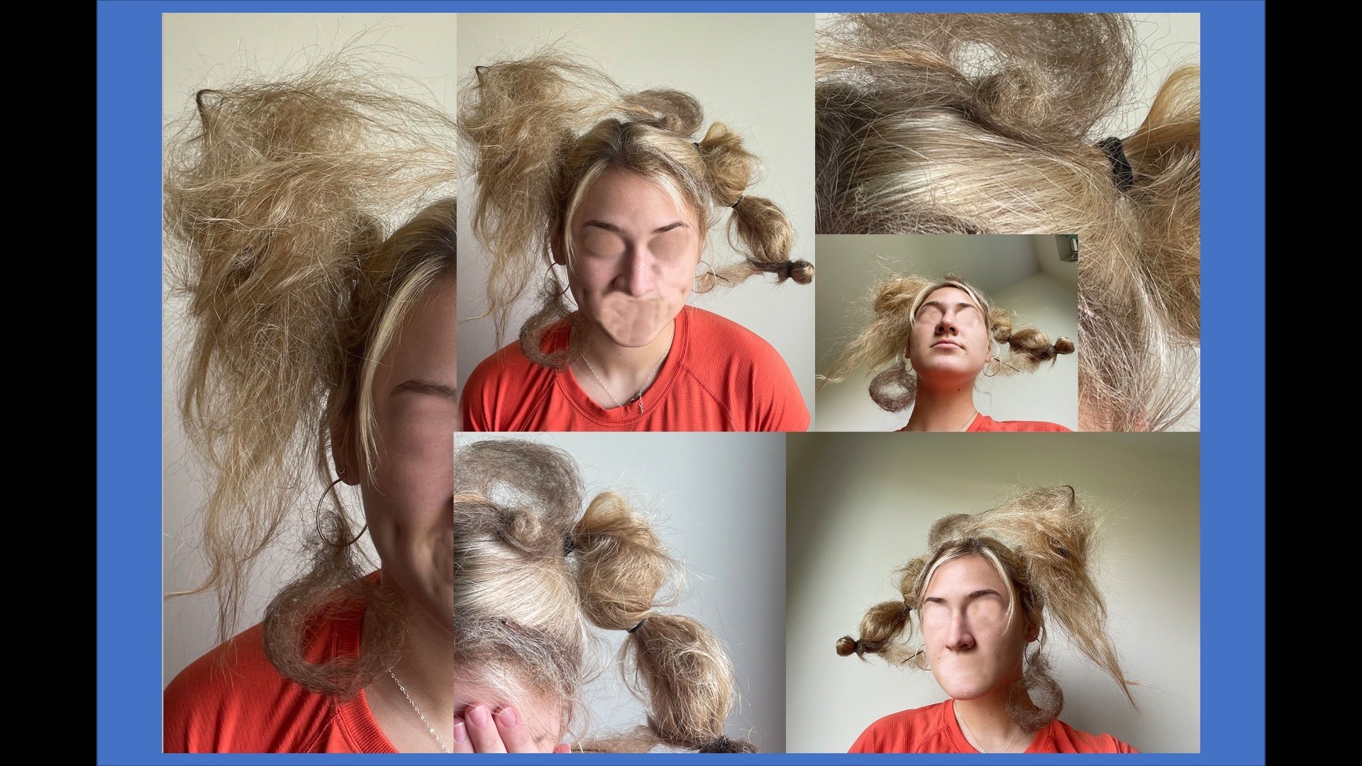 grid photos of person’s head with tangled and knotted hair extending outward